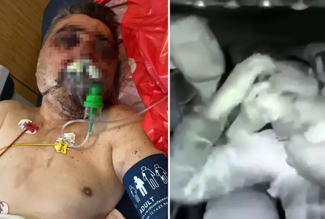 İngiliz boksörün Türk şoförü komalık ettiği anlar kamerada