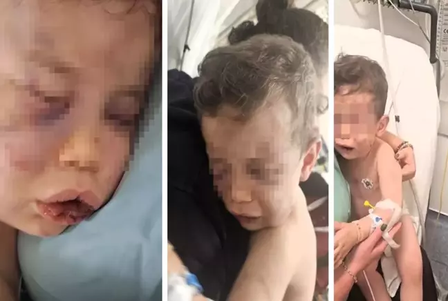 2 yaşındaki bebek annesinin sevgilisi tarafından öldüresiye dövüldü