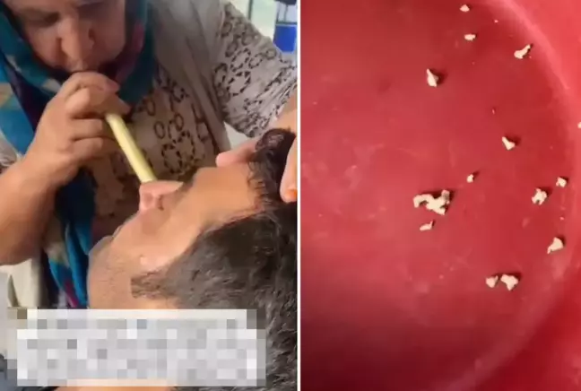 Hindistan değil Adana! Bu saçmalığa inanıp tedavi için gidenler var
