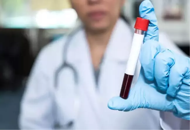 Hepatit C Nedir, Nasıl Bulaşır?