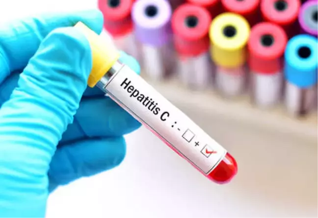 Türkiye'de Her 100 Kişiden 1'i Hepatit C Hastası