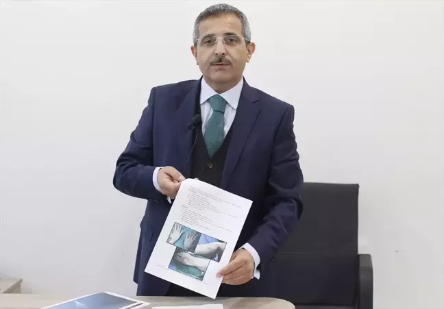 Acil Tıp Uzmanı Prof. Dr. Al, İsrail'in Gazze'de beyaz fosfor kullandığını gösteren delilleri AA'ya değerlendirdi Açıklaması