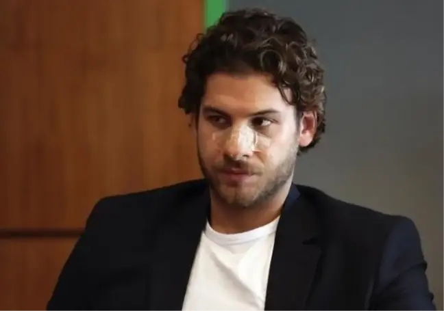 Mustafa Mert Koç estetikli mi? Mustafa Mert Koç estetik mi oldu?