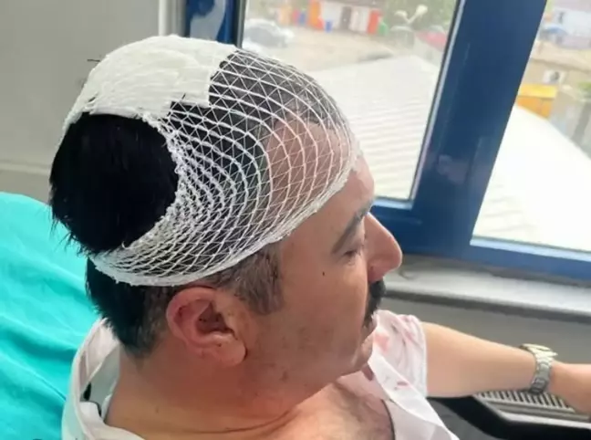 Kahramanmaraş'ta Belediye Başkan Yardımcısına Şekerlikle Saldırı