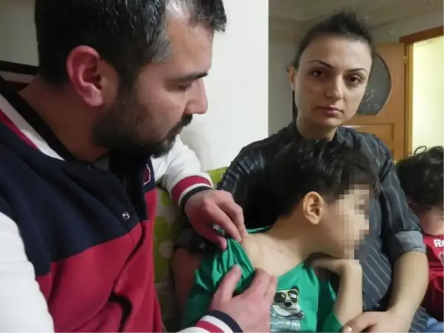 Anaokulundaki Çocuğun Boynundaki Çiziklere Karşılıklı Suçlama