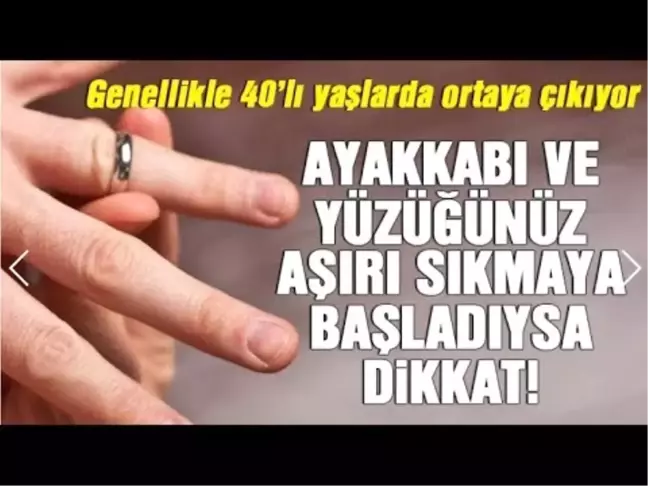 Ayakkabı ve Yüzüğünüz Aşırı Sıkmaya Başladı İse Dikkat..!!