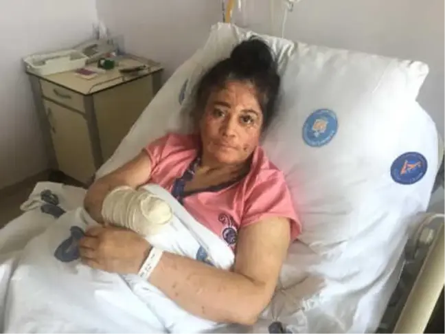 Deri Hastası Anne: Kızımın Bana Annelik Yapması Çok Acı