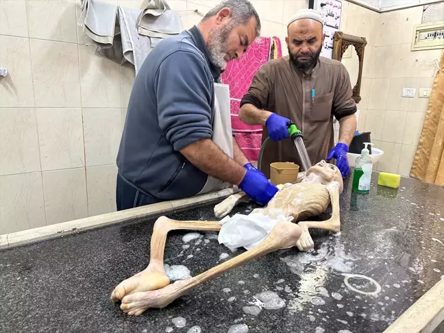 İsrail saldırıları sonucu açlıktan ölen çocuk sayısı artıyor