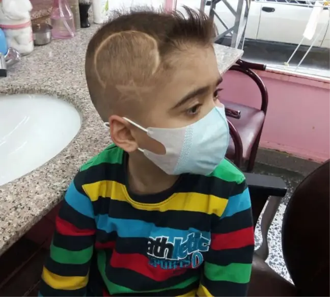 Ölümcül Hastalığa Yakalanan Çocuk Kafasında Ay ve Yıldız Taşıyor