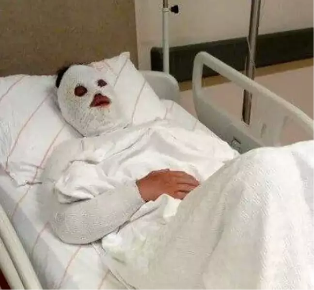 Eski nişanlısına kimyasal sıvı atan kişiye 15 yıl hapis cezası