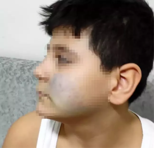Başkent'te akran şiddeti iddiası