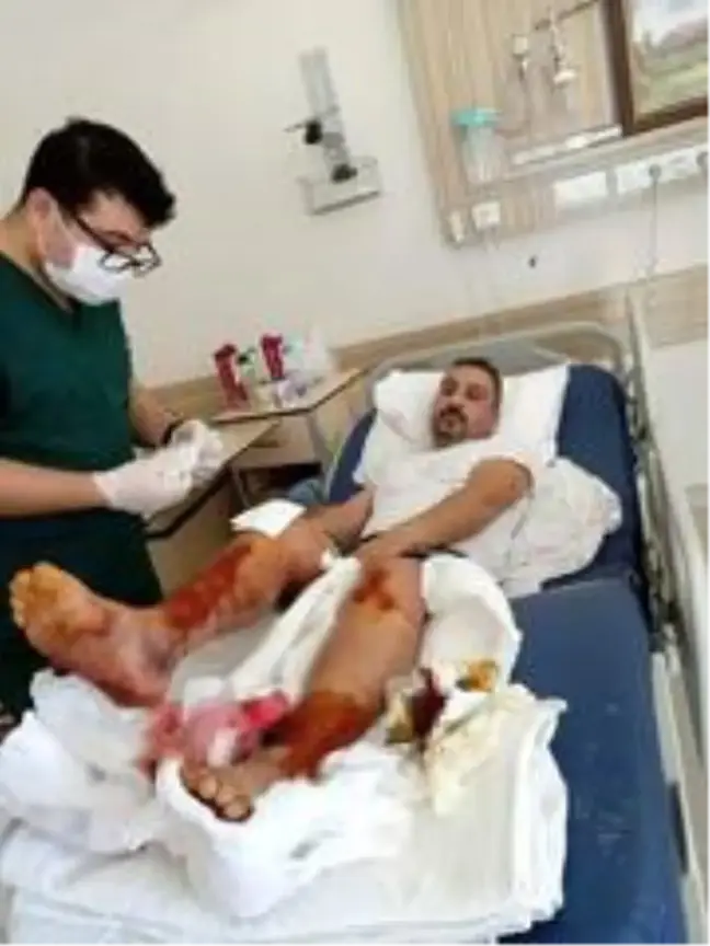 Karabük'te silahlı yaralama