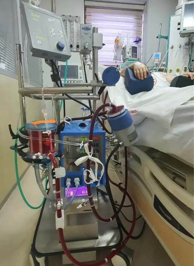 YAŞAMIN DURDUĞU NOKTADA ECMO TEDAVİSİYLE MUCİZE BAŞARIYORLAR