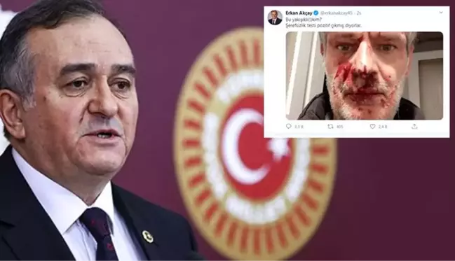 MHP'li Grup Başkanvekili Erkan Akçay, darp edilen yazarın fotoğrafını paylaştı