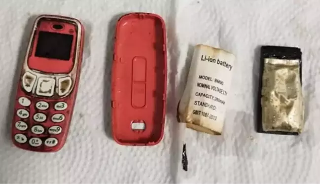 Kosova'da 33 yaşındaki bir hastanın midesinden Nokia 3310 çıkarıldı