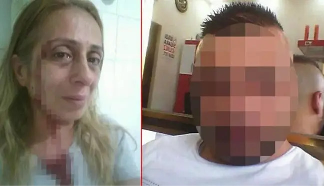 Uyuşturucu bağımlısı oğlundan şiddet gören annenin acı feryadı: Can güvenliğimiz yok, bizi öldürmesinden korkuyoruz