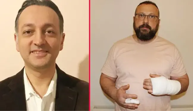 Bu sefer doktor doktoru dövdü! Meslektaşını yoğun bakımlık yapan profesör kendini savundu: Mobbing uyguluyordu