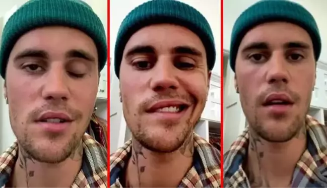 Yüz felci geçiren Justin Bieber, sağlık durumu hakkında bilgi verdi: Her gün daha iyiye gidiyorum