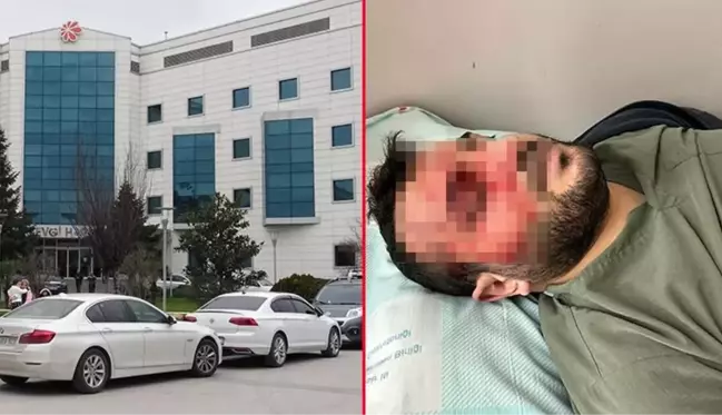 Balıkesir'de hastanede doktor kavgası! Ameliyatta başlayan tartışma kanlı bitti