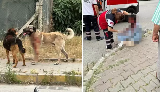 İstanbul'da köpek saldırısına uğrayan kadın gözünü kaybetti