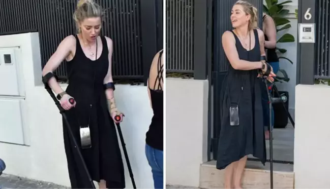 Johnny Depp'e açtığı davayı kaybettikten sonra İspanya'ya taşınan Amber Heard'ün koltuk değnekli hali sevenlerini korkuttu