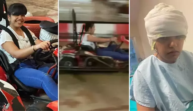 Go-kart'ta saçı tekerleğe dolanan genç kız ölümden döndü