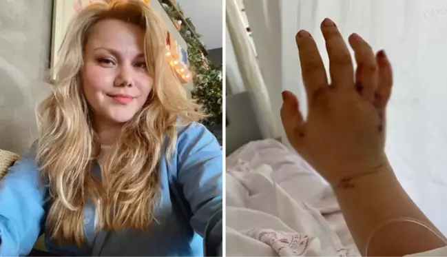 Eşi tarafından 58 yerinden bıçaklanan YouTuber Merve Veziroğlu korkunç anı anlattı: Gözümü açtığımda kanlar fışkırıyordu