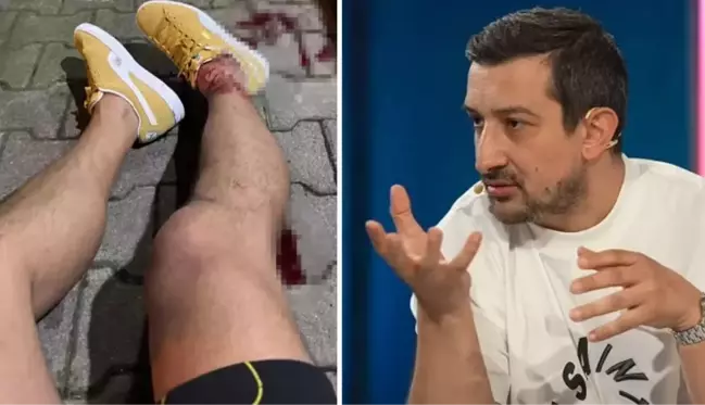 Her şey saniyeler içinde olmuş! İşte Serhat Akın'ın vurulma anı