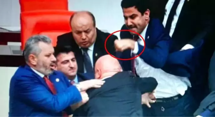 AK Partili vekilin eli, CHP'li Engin Özkoç'a attığı yumruk nedeniyle üç yerden kırıldı