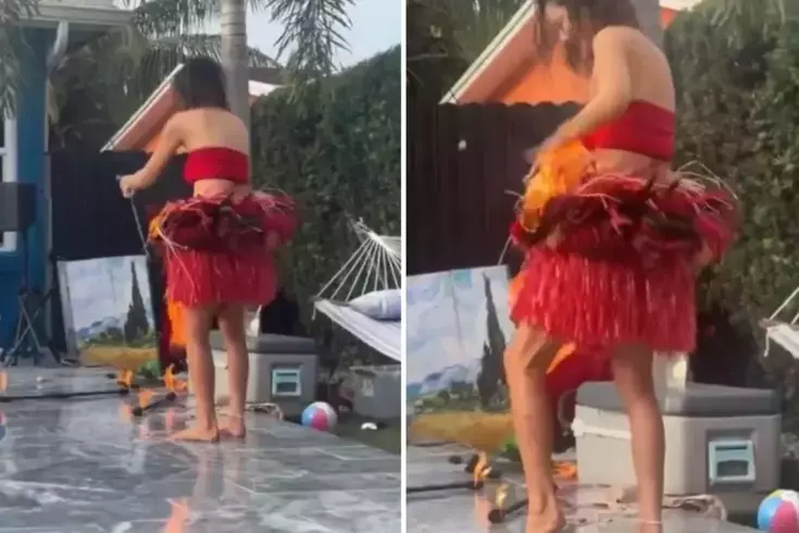 Alevli şov yapmak istedi, kendini yaktı! Son anda kurtuldu