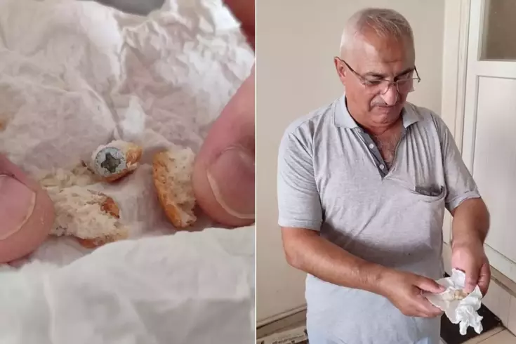 Ekmekten öyle bir şey çıktı ki! Neredeyse dişini kaybedecekti