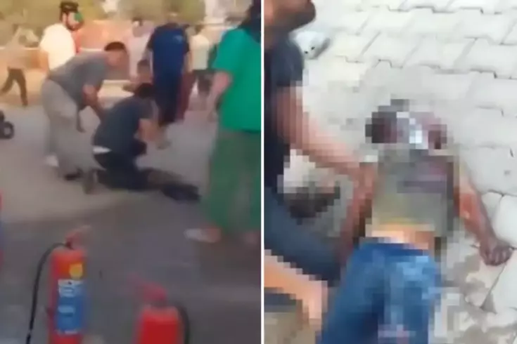 Konteynerde çıkan yangında küçük çocuk ağır yaralandı