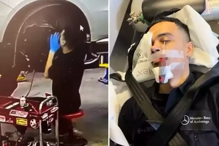 Otomobil tamirinde korkutan kaza! İşçinin gözüne tornavida saplandı
