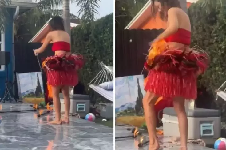 Alevli şov yapmak istedi, kendini yaktı! Son anda kurtuldu
