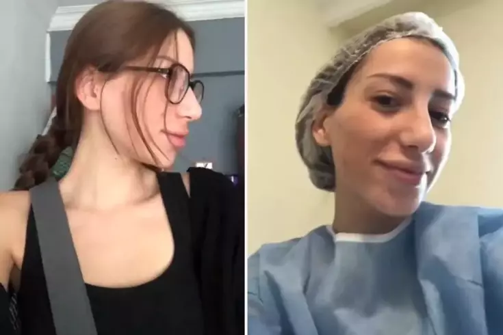 Devlet hastanesinde burun ameliyatı oldu! İşte genç kadının yaşadığı değişim