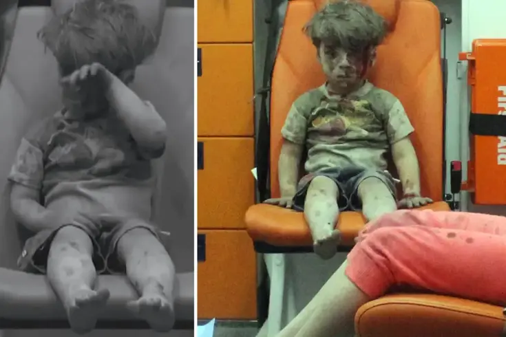 Bakın nerede ortaya çıktı: İşte dünya gündemine oturan Ümran bebeğin son hali