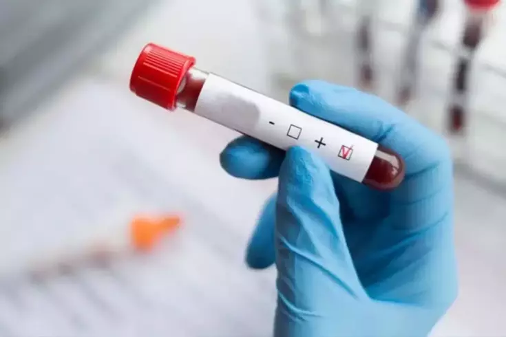 Dünyada vakalar azalıyor, Türkiye'de ise HIV artıyor