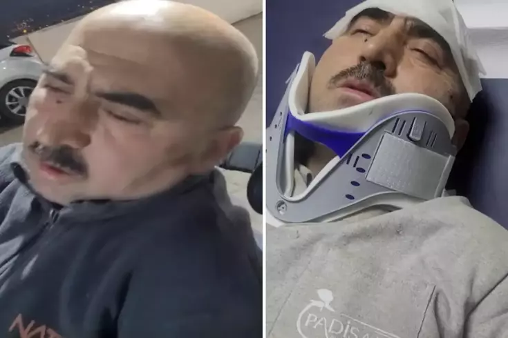 Sigortasız çalıştırılan işçiye patron ve oğlundan öldüresiye dayak