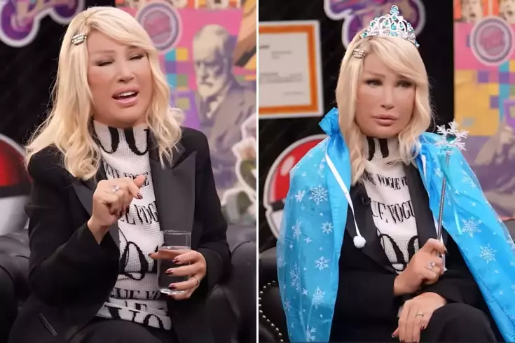 Seda Sayan'ın yüzündeki şişliğin sebebi ortaya çıktı