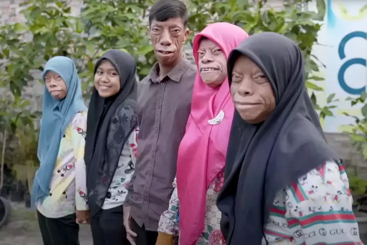 Dünya onları konuşuyor! Kertenkele Ailesi kısa sürede fenomen oldu