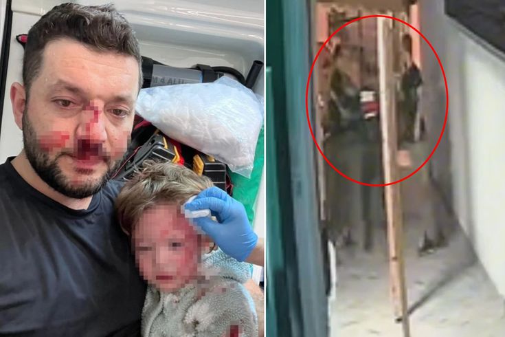 Yalova'da baba ile 14 aylık bebeğinin darbedildiği görüntüler ortaya çıktı