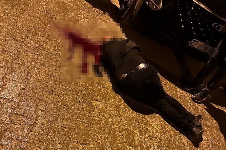 Sokakta yürürken tabanca ile başından vuruldu