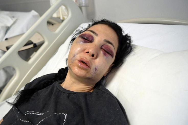 Oğlunun gözü önünde anneyi öldüresiye dövdüler: Küfür etmeyin dedik diye bu hale geldim
