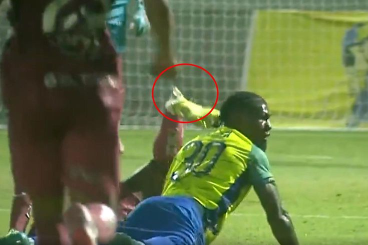 The young footballer's leg was broken! The moments were captured on camera