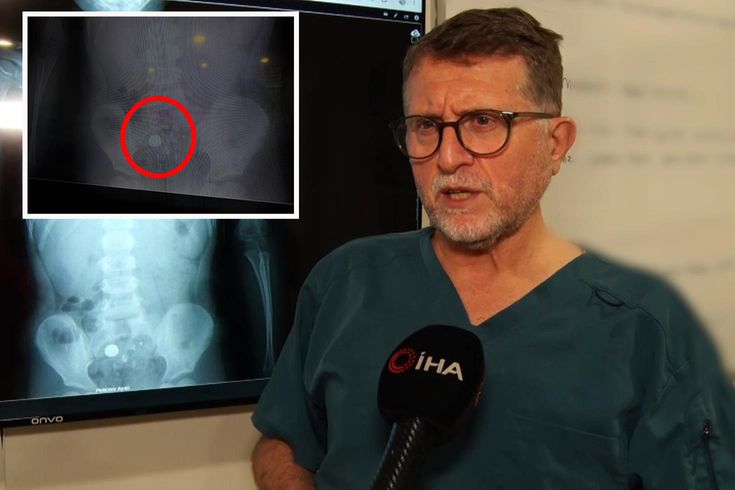 Şeker sanıp yuttu, pil olduğu filmde ortaya çıktı: Ölüme kadar götürebiliyor