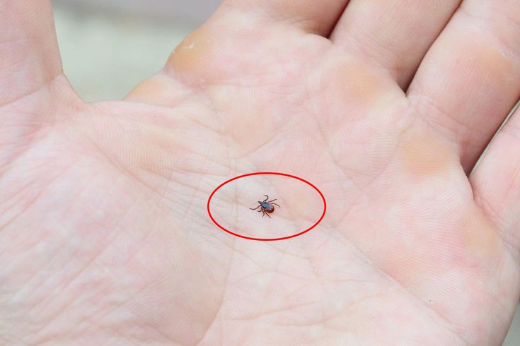Kene popülasyonu arttı, uzmanlar tedbir çağrısı yaptı