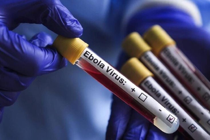 KKTC'den Ebola virüsüne karşı yeni tedbirler