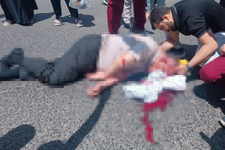 Üniversite kampüsünde korkunç kaza