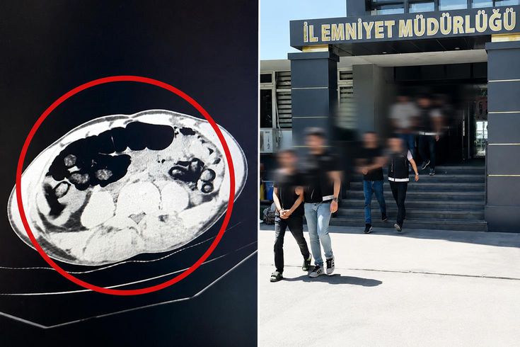Batman’da akıllara durgunluk veren olay: Yolcu otobüsünde yakalanan 4 şüphelinin midesinden kilo kilo uyuşturucu çıktı