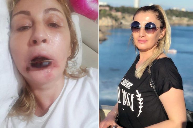 Güzelleşeyim derken bu hale geldi